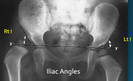 <p>Q what is the name of this measurement? and what is the average + range?</p>