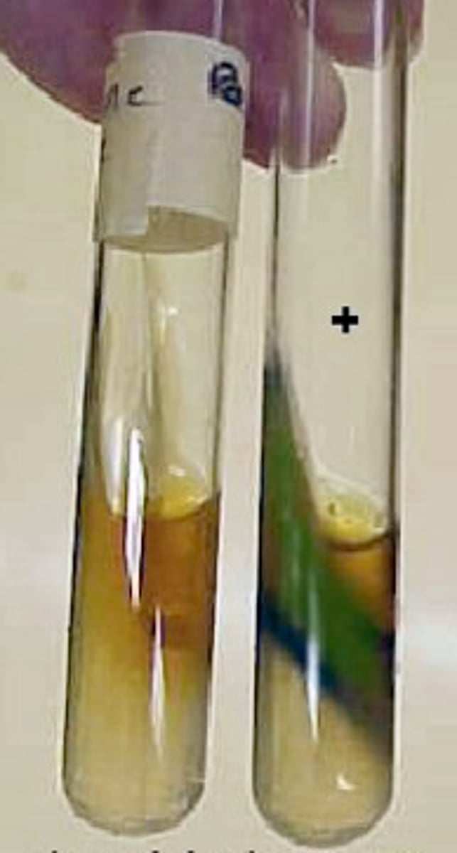<p>Phenylalanine Deaminase (PDA) Test</p>