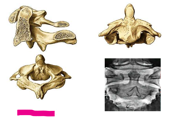 <p>Halswirbelsäule</p>