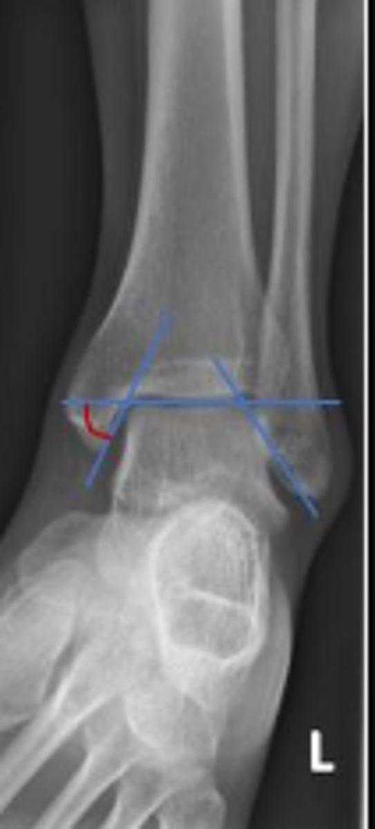 <p>What is the name of the assessment?</p>