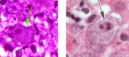 <p>What is this?</p><ul><li><p>no flagellated</p></li></ul><p></p>