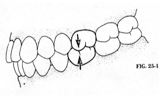 <p>Class I</p>