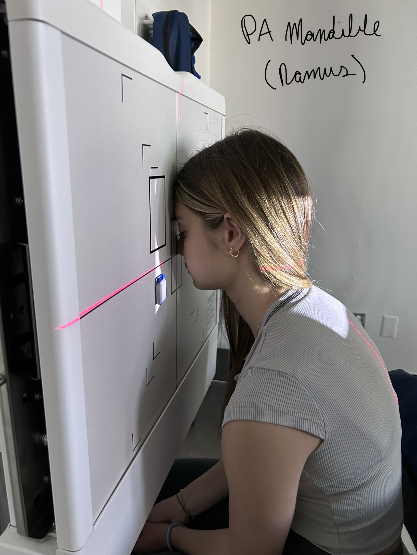 40” SID, 8” x 10” lw, MSP and OML perpendicular to IR, centering to MSP and exiting through acanthion