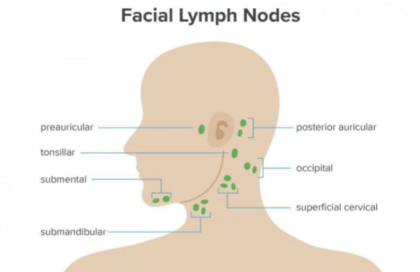 <p>Preauricular site is commonly affected. Lateral 1/3 of the eye drains into the preauricular lymph node.&nbsp;</p>