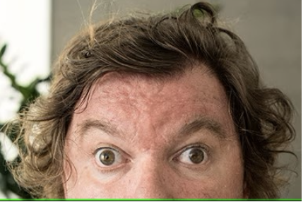 <ul><li><p><span>How would you document the assessment findings of this patient’s eyes?</span></p></li><li><p><span>How would you assess for this disorder?</span></p></li></ul><p></p>