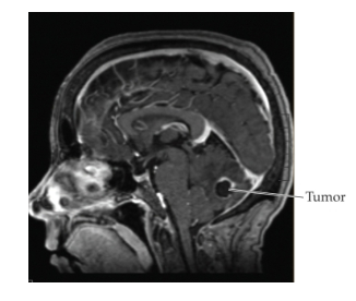<p>uses the responses of atoms to strong magnetic fields to form images of structures like the brain.</p>