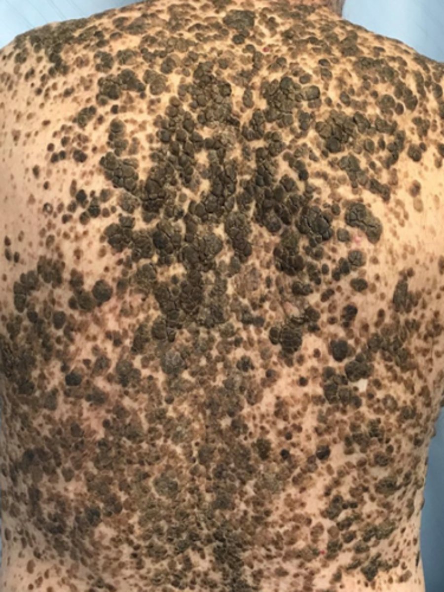 <p>What is the diagnosis?</p>