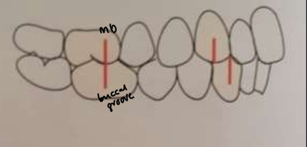 <p>1st upper molar mesiobuccal cusp occludes with 1st lower Buccal groove </p>