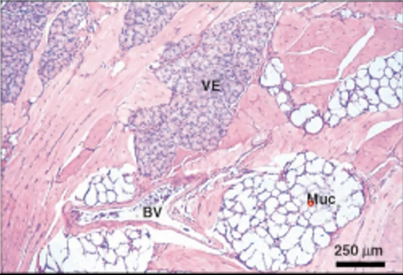 <p>Serous glands on our tongue associated with papillae that have lots of taste buds with them</p><ul><li><p>Posterolingual in the tongue</p></li><li><p>Secretions are released in areas with significant number of taste buds</p></li><li><p>Near the troughs and clefs of circumvallate and foliate papille</p></li></ul><p></p>