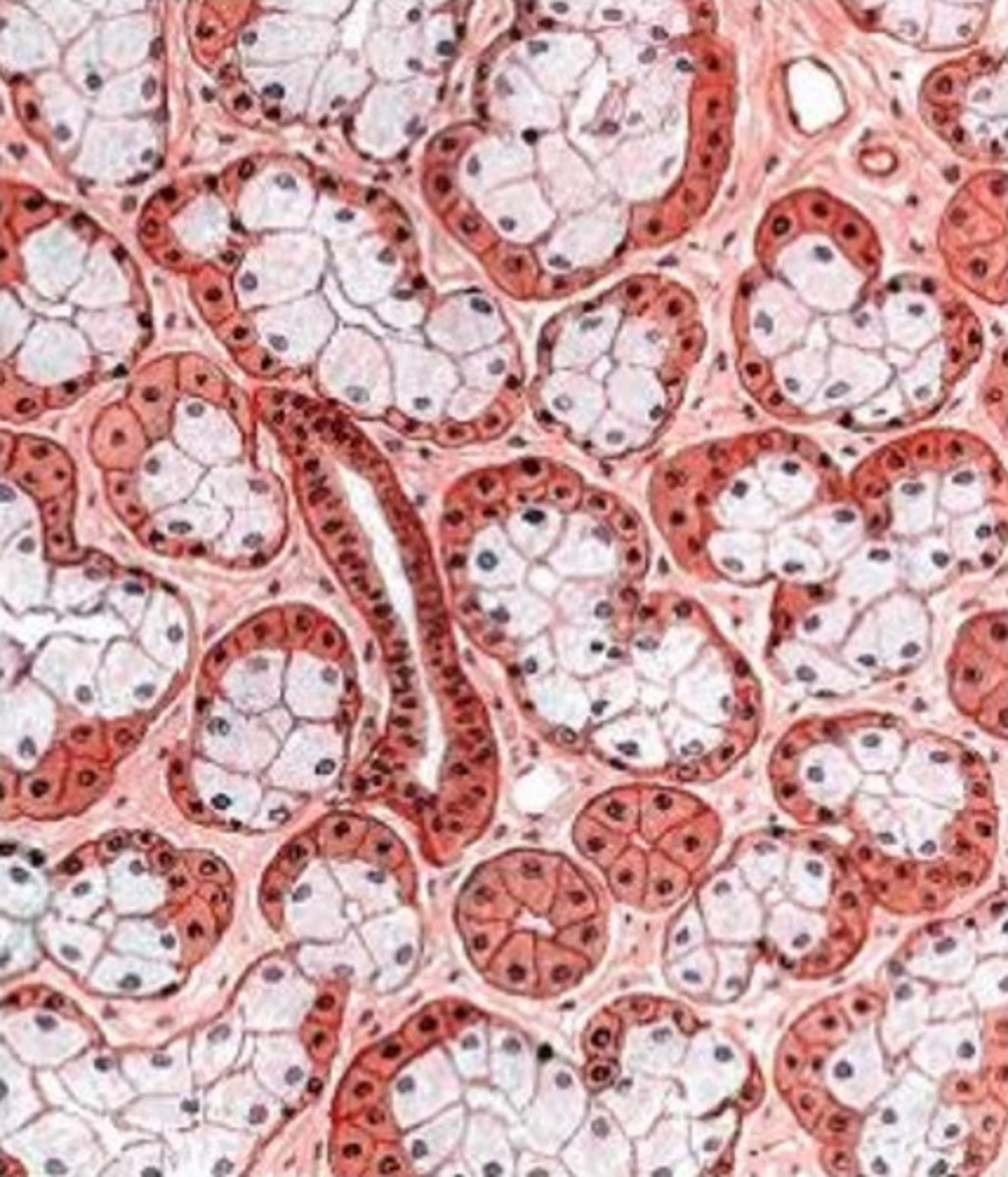 <p>what gland is this from? how do you know?</p>