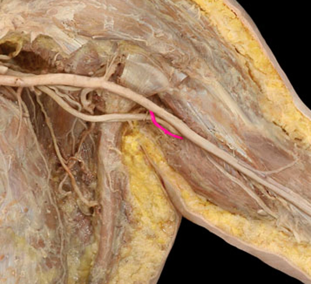 <p>branch off of the brachial artery</p>