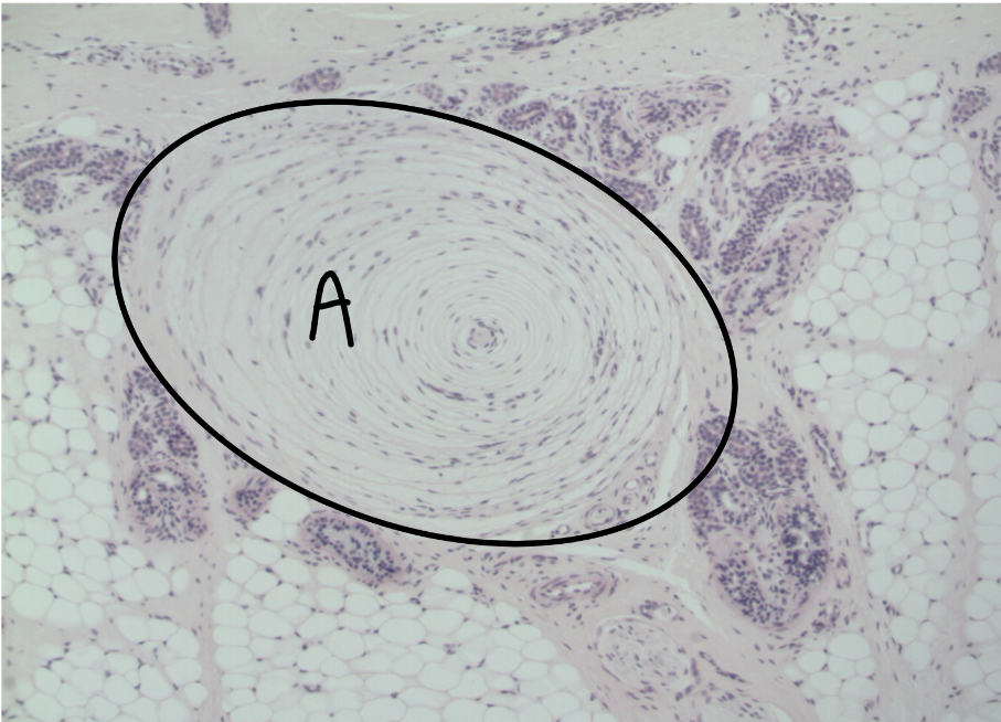 <p>Hypodermis</p><p></p><p>A: Pacinian corpuscle</p><ul><li><p>detects deep touch</p></li><li><p>located in the hypodermis</p><ul><li><p>surrounded by fat cells </p></li></ul></li></ul><p></p>