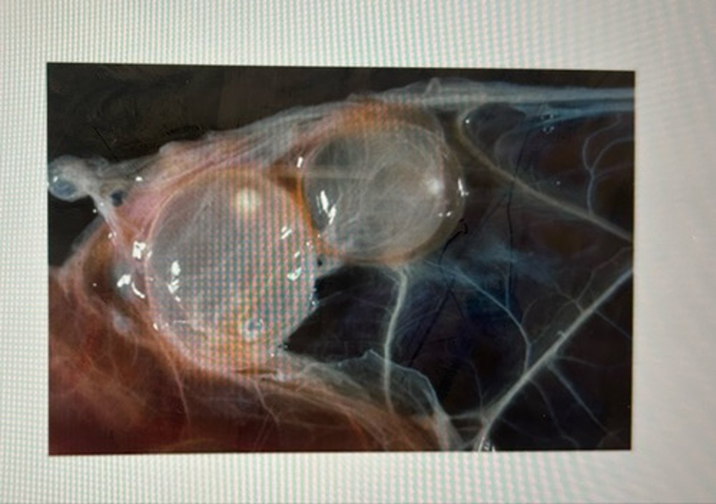 <p>This larval metacestode stage is fluid-filled in the tissue of mammalian intermediate hosts. It is commonly called the "bladder worm" stage but the correct name of this larval stage is..</p>