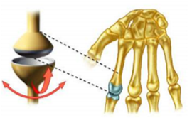 <p>What type of joint is this?</p>