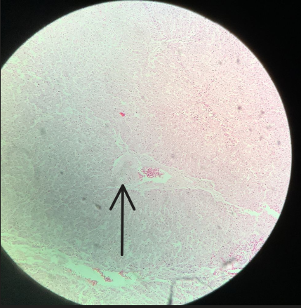 <p>Estructura</p>