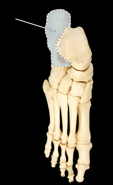 <p>Name this bone.</p><p>(Superior view, right side).</p>