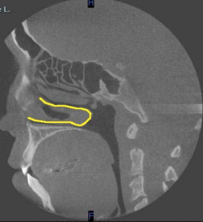 <p>identify the structure</p>