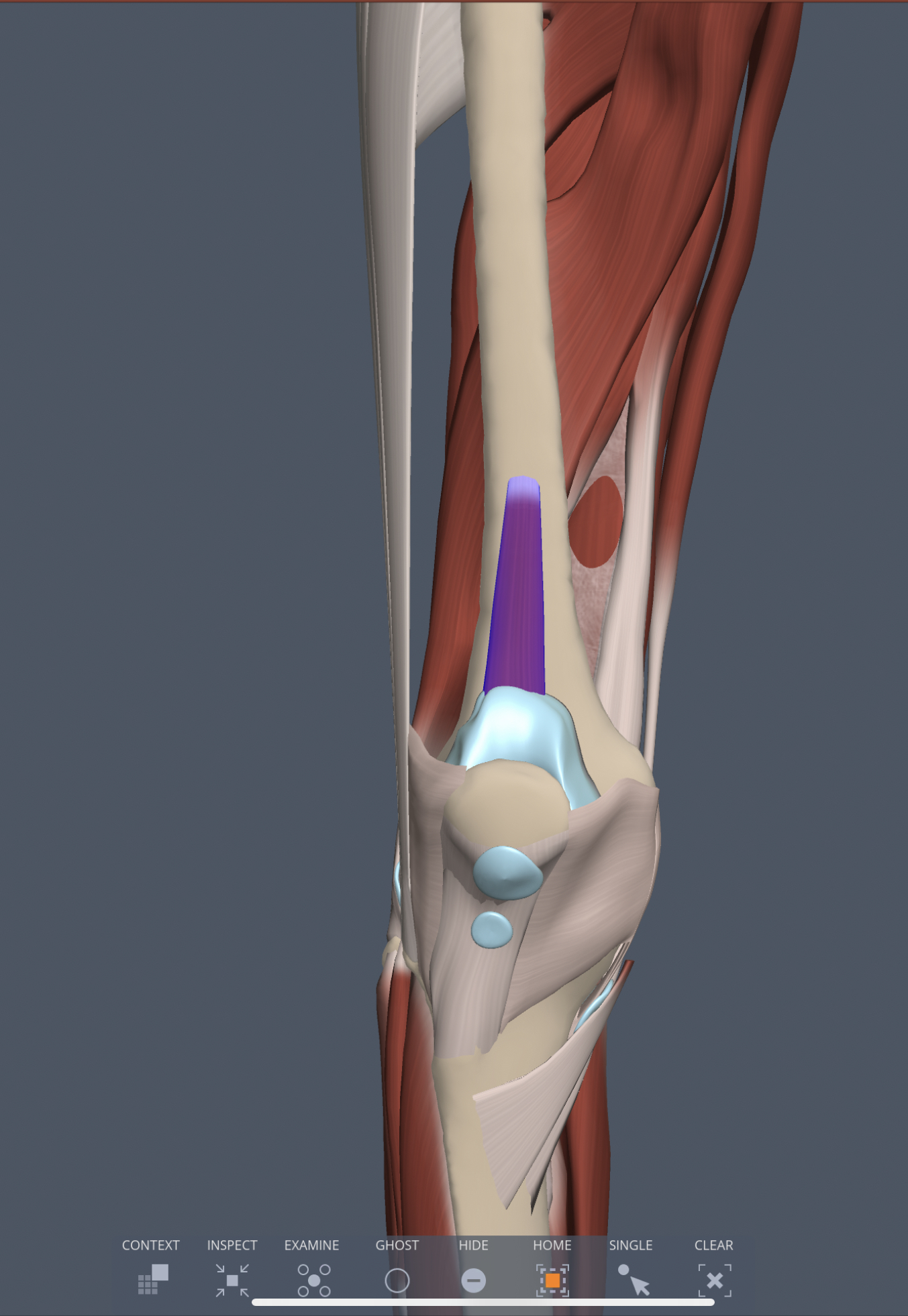 articularis genu (anterior thigh) origin
