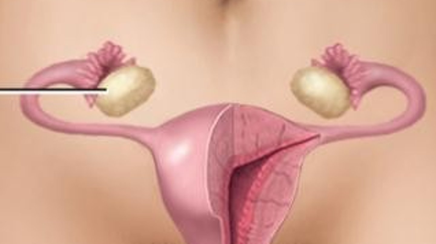 <p>The ______ are the organs in the female body that produce egg cells.</p>