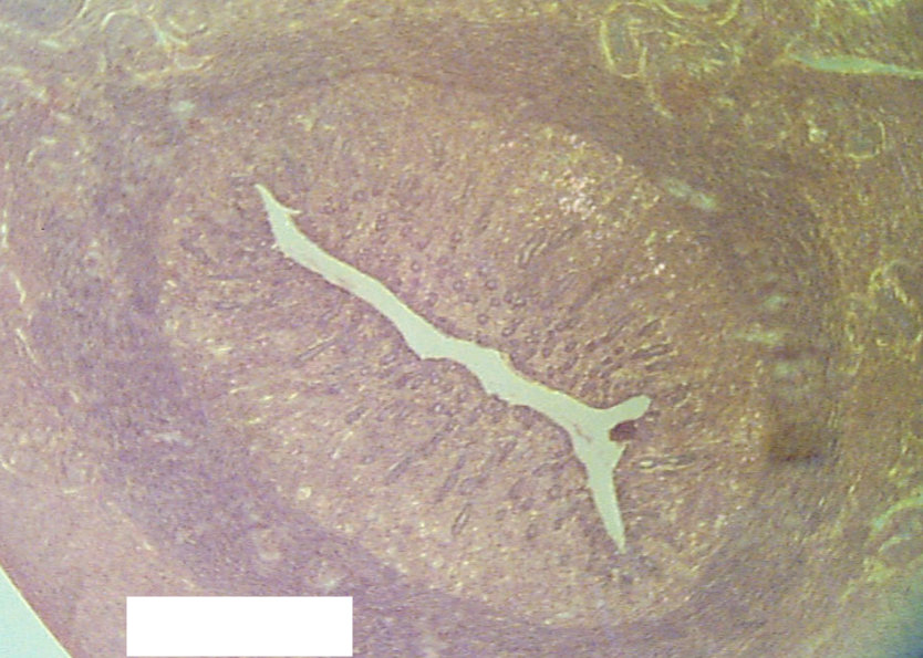 <p>Which phase of estrus is this ovary experiencing?</p>