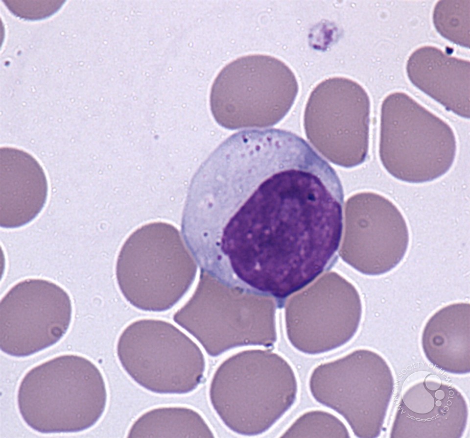 <ul><li><p>size: 15-18 um</p></li><li><p>a lot of cytoplasm, light-blue in color</p></li><li><p>dark purple nucleus</p></li></ul><p></p>
