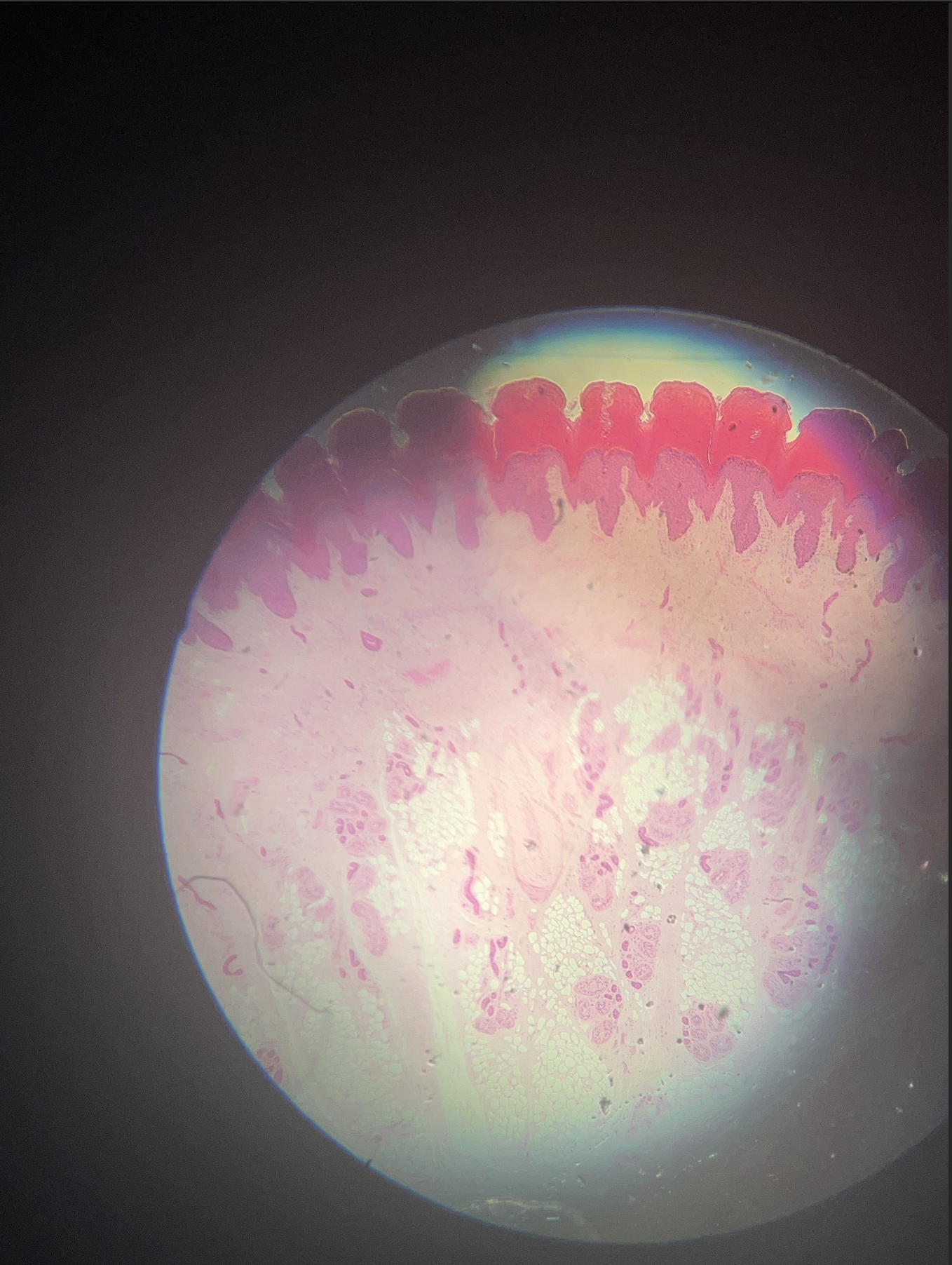 <p>what specimen is this?</p><p>identify the stratum corneum, stratum grandulosum, and stratum germinativum</p>
