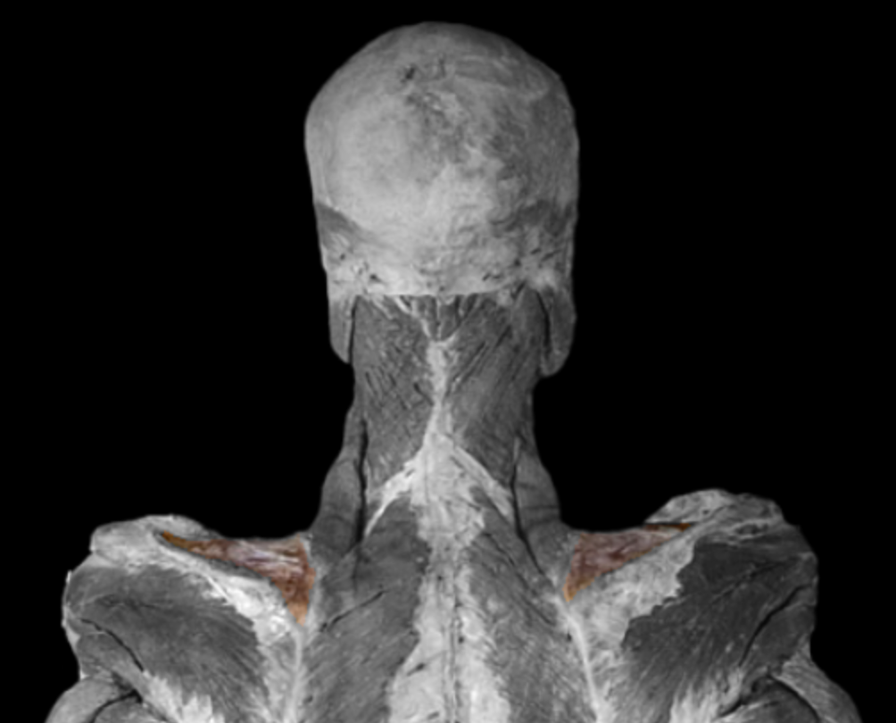 <p>What muscle is this?</p>