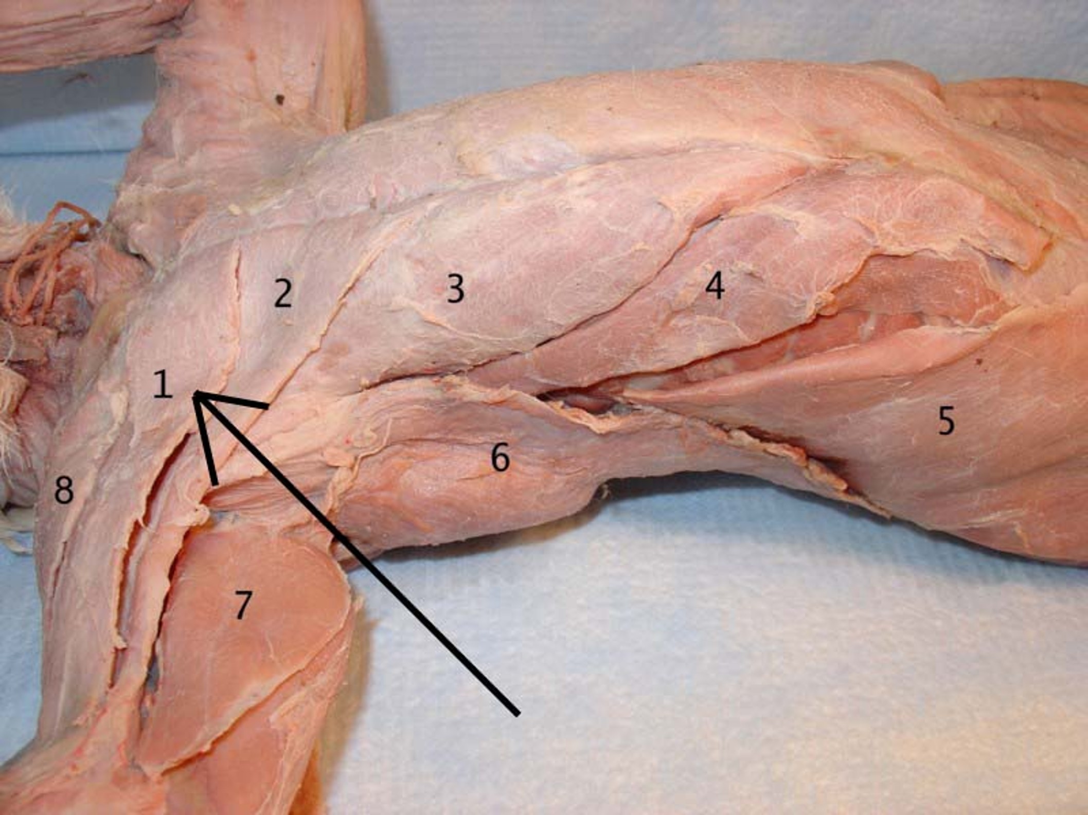<p>What is the muscle indicated by number 8? What is an attachment point and function?</p>