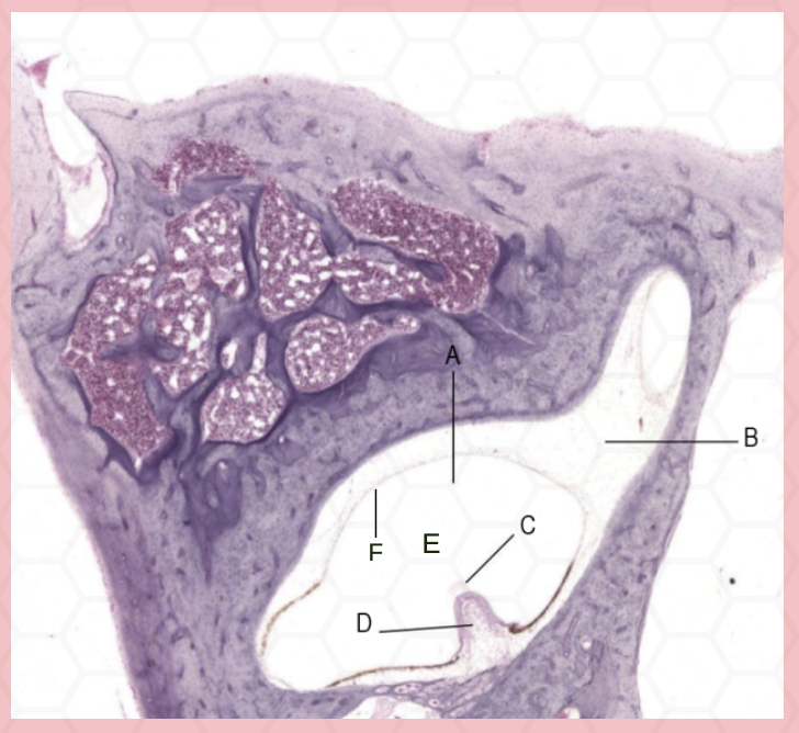 <p>Identify the structure labeled as A.</p>