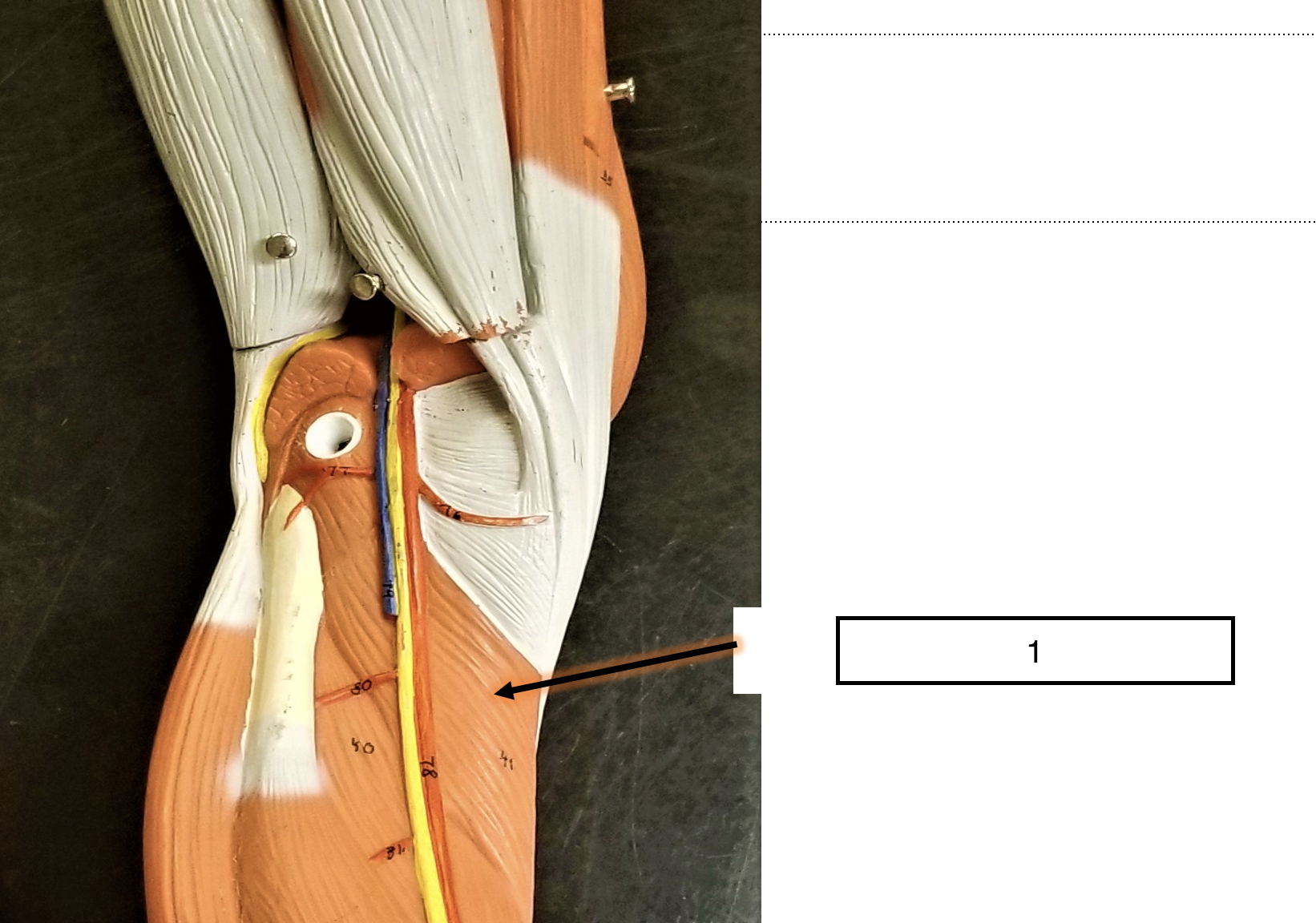 <p>name the muscle (1)</p>