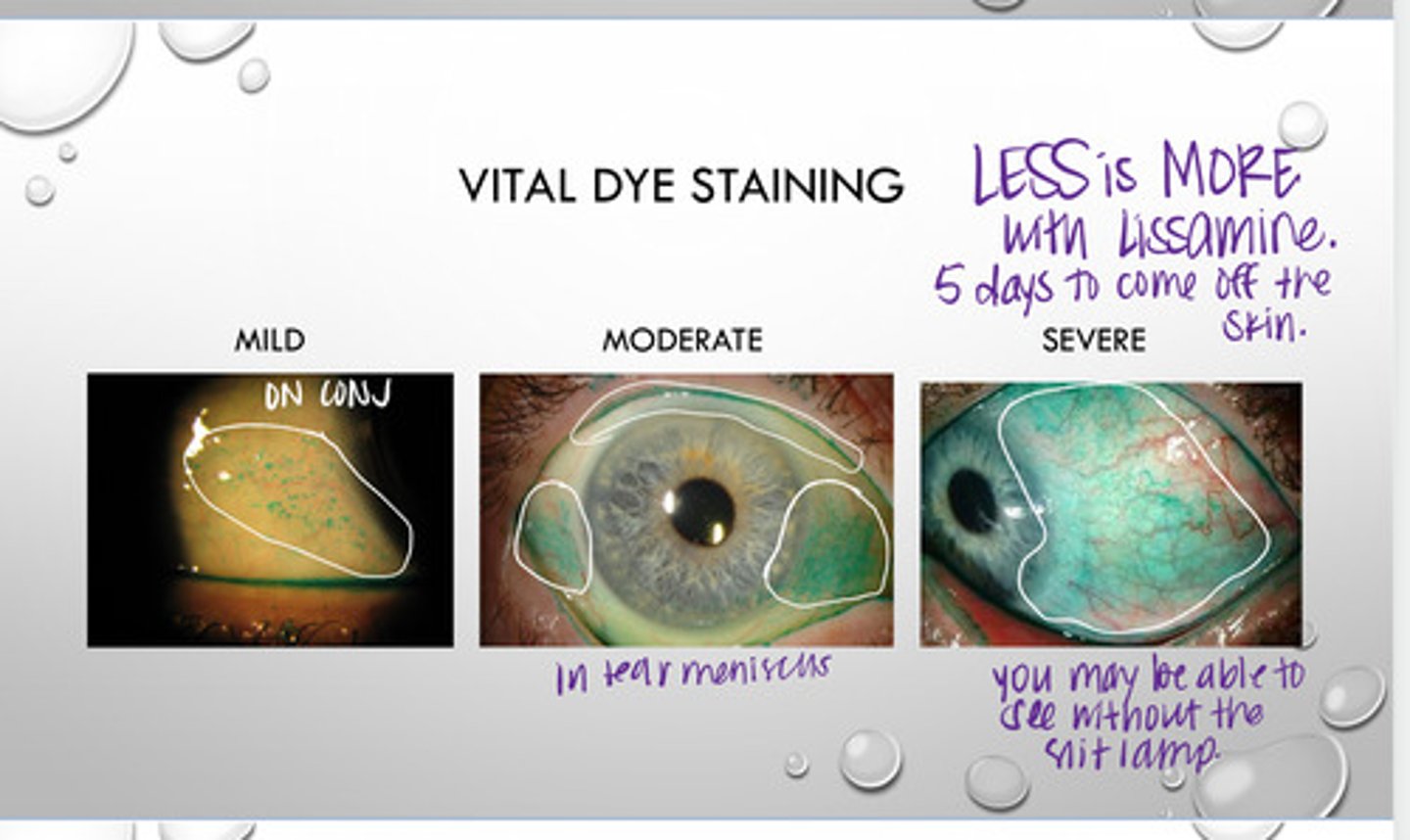 <p>What is the Lissamine Green Stain used to evaluate?</p>