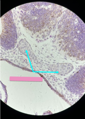 <p>what level<br>primary brain vesicle<br>parts</p>