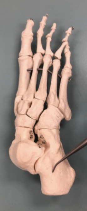 <p><span style="font-family: -apple-system, system-ui, Segoe UI, Roboto, Helvetica Neue, Arial, Noto Sans, Liberation Sans, sans-serif, Apple Color Emoji, Segoe UI Emoji, Segoe UI Symbol, Noto Color Emoji">Identify this bone.</span></p>