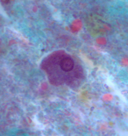 <p>Professor: Dr. Glena Fe A. Yapchulay-Alcabasa</p>