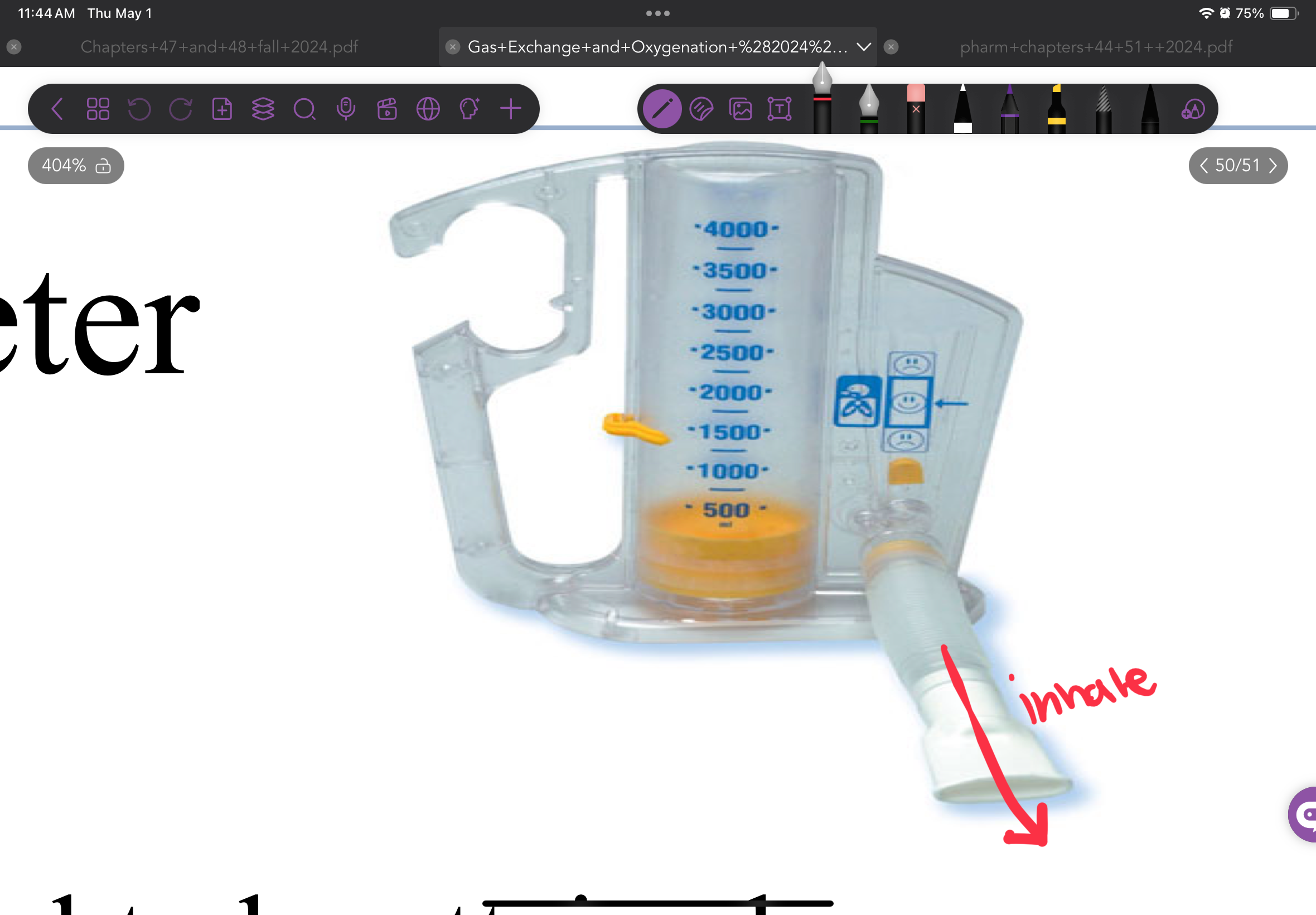 <p>It a device that the pts sucks in and it treats Atelectasis</p>