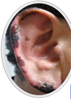 <p>What is this disorder</p>