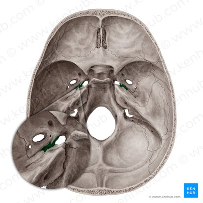 <p>What enters the cranium via the carotid cana?</p>