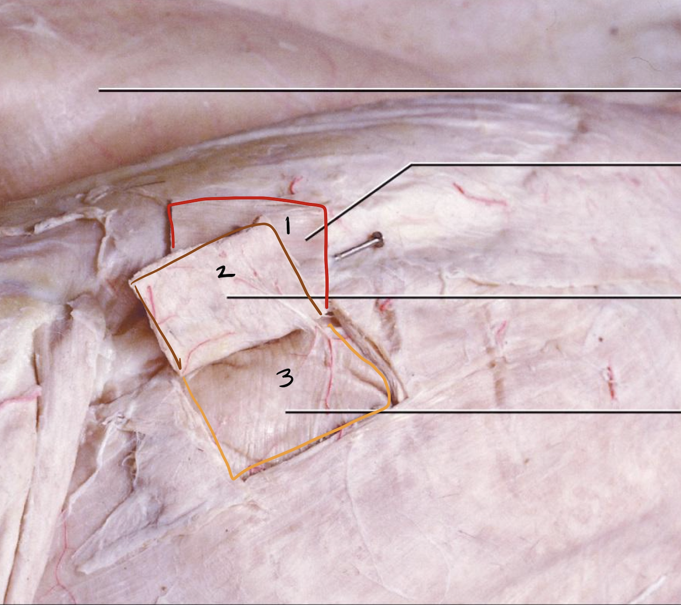 <p>1</p>