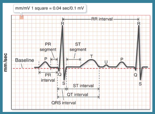 <p>True/False: A nurse doesn’t need to know what a normal ECG looks like</p>