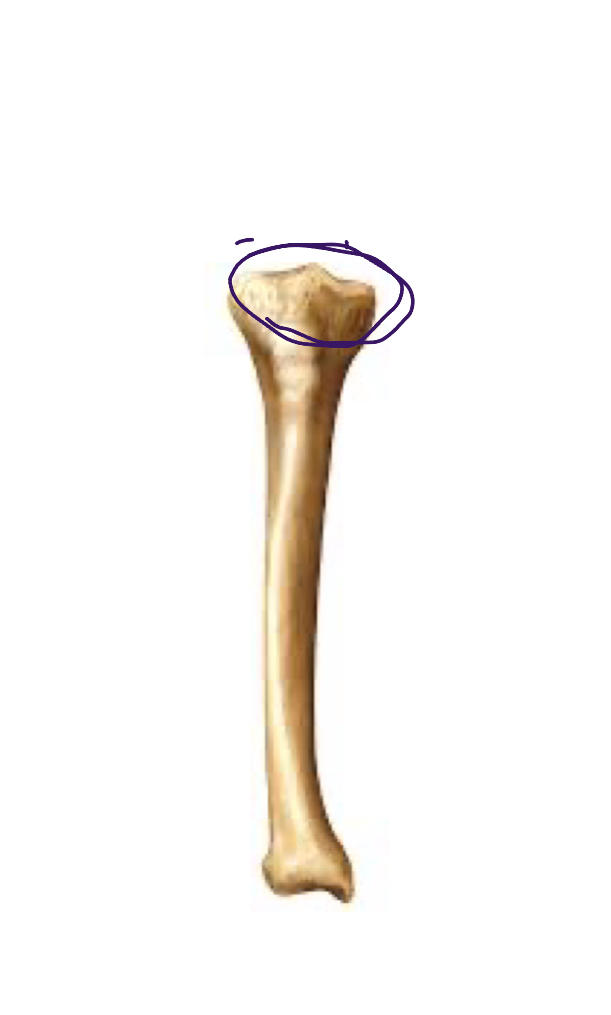 <p>Attaches to patella, top of tibia</p>