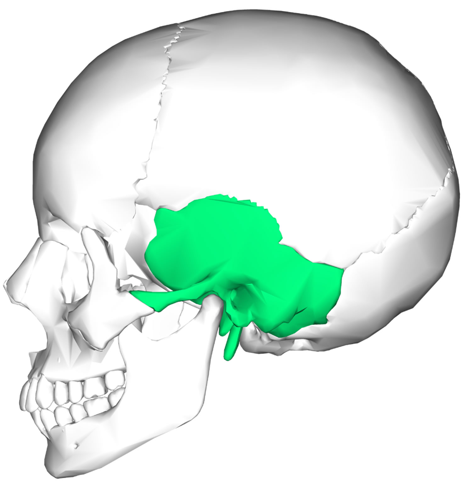 term image
