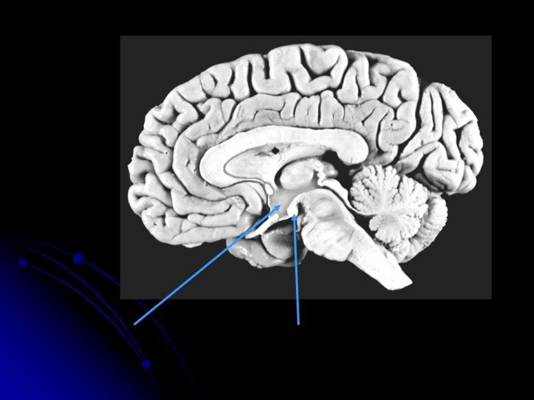 <p>second arrow </p>