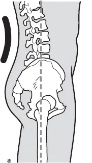 Normal curve of lumbar spine forwards/anterior
