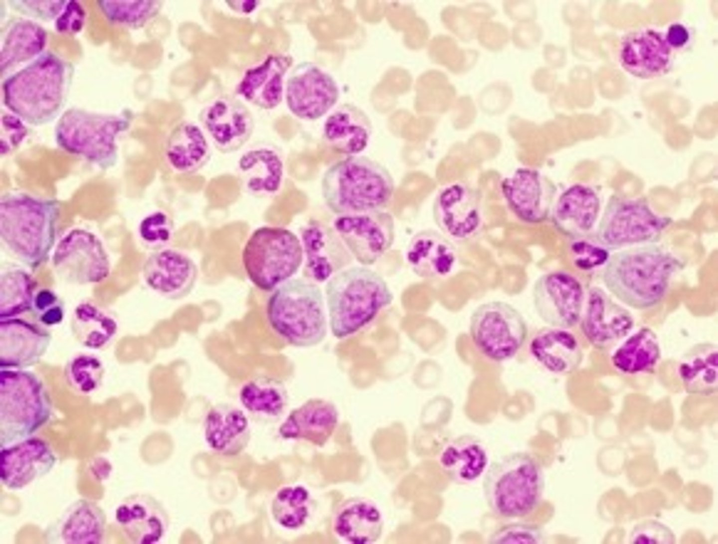 <p>Where would the band cells visible in this blood film below normally be found?</p>