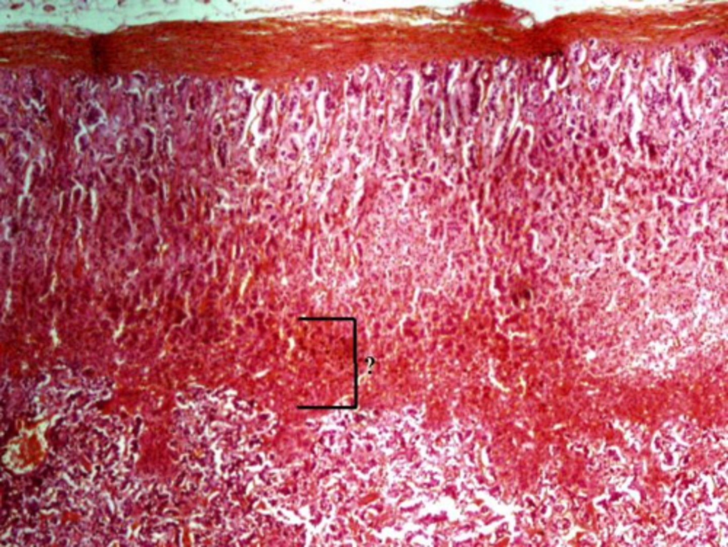 <p>Identify the indicated layer of the adrenal gland.</p>