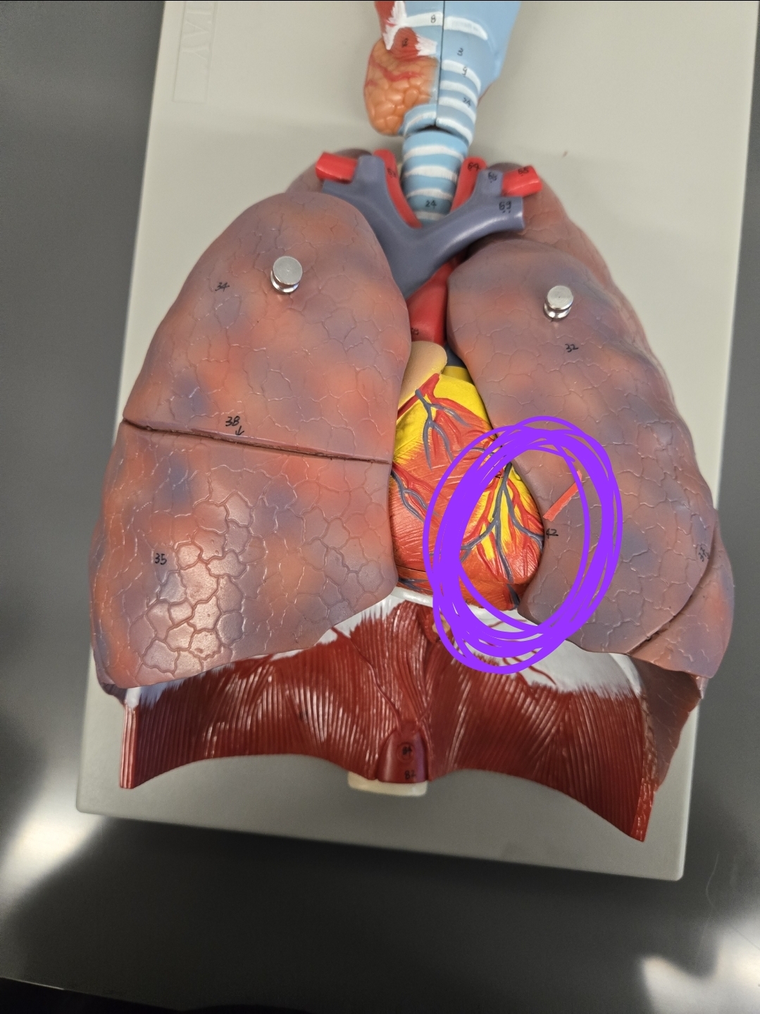 <p>What part of the lungs is this?</p>