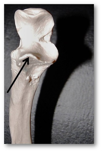 Name this specific part of the ulna.