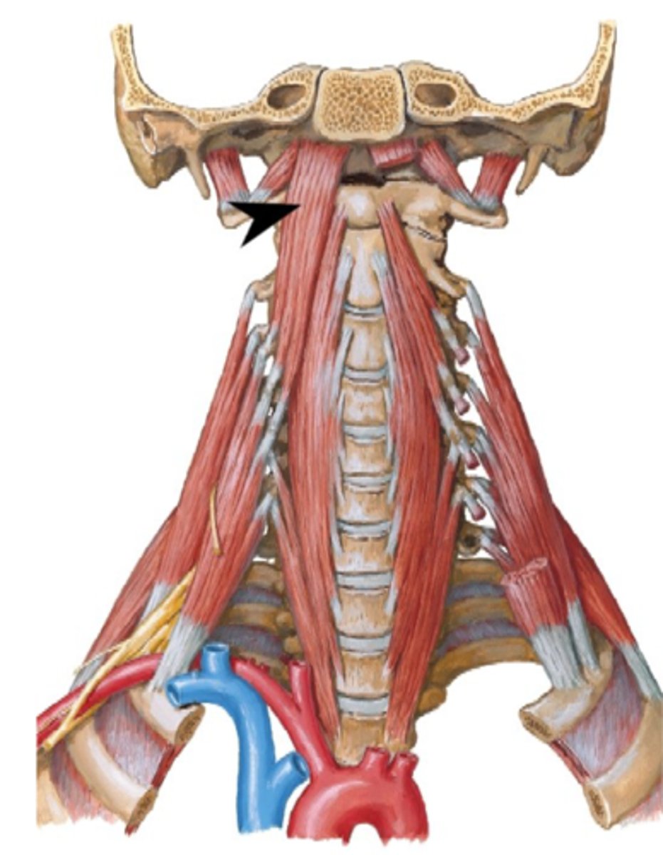 <p>What is this muscle?</p>