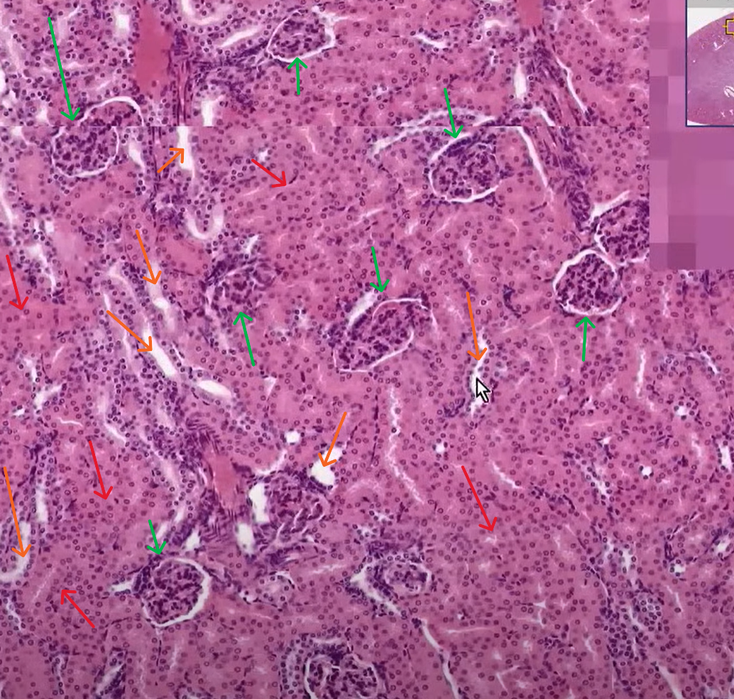 <p>Organ?</p><p>Outermost layer surrounding organ?</p><p>Entire circular structures at green arrows?</p><p>Generally speaking red arrow structures are?</p><p>Generally speaking orange arrow structures are?</p>