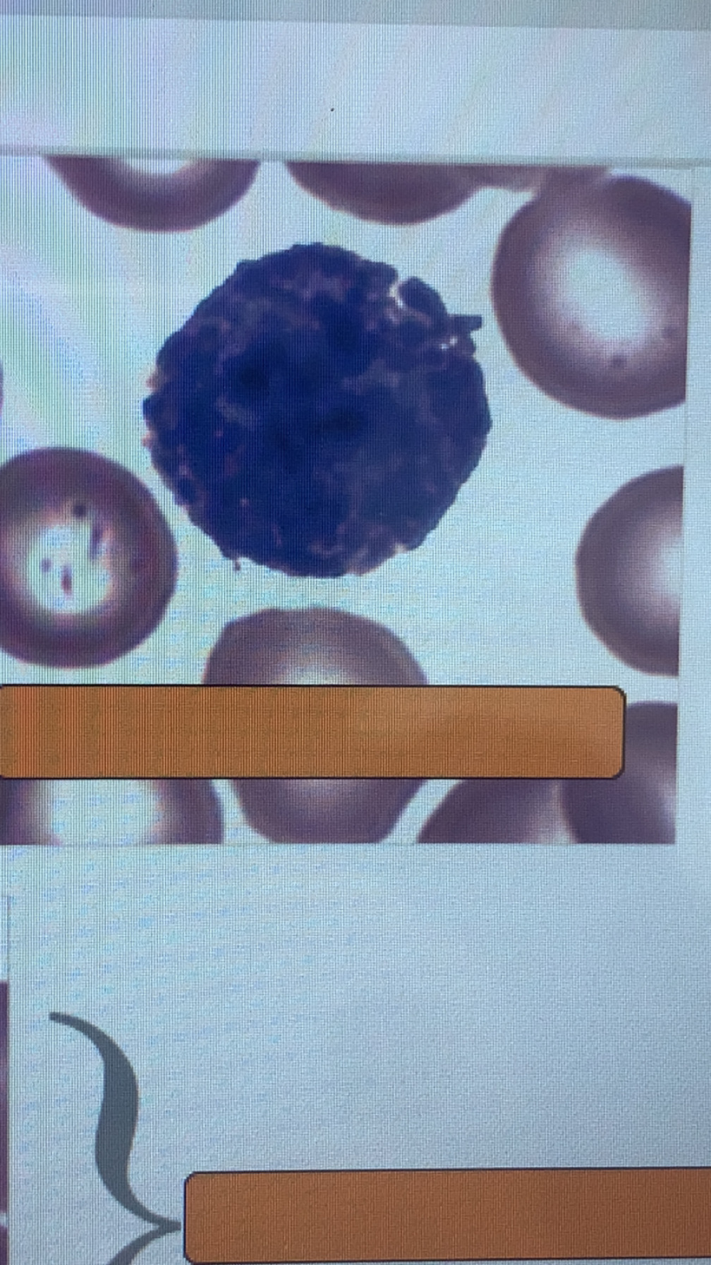 <p>basophil </p>